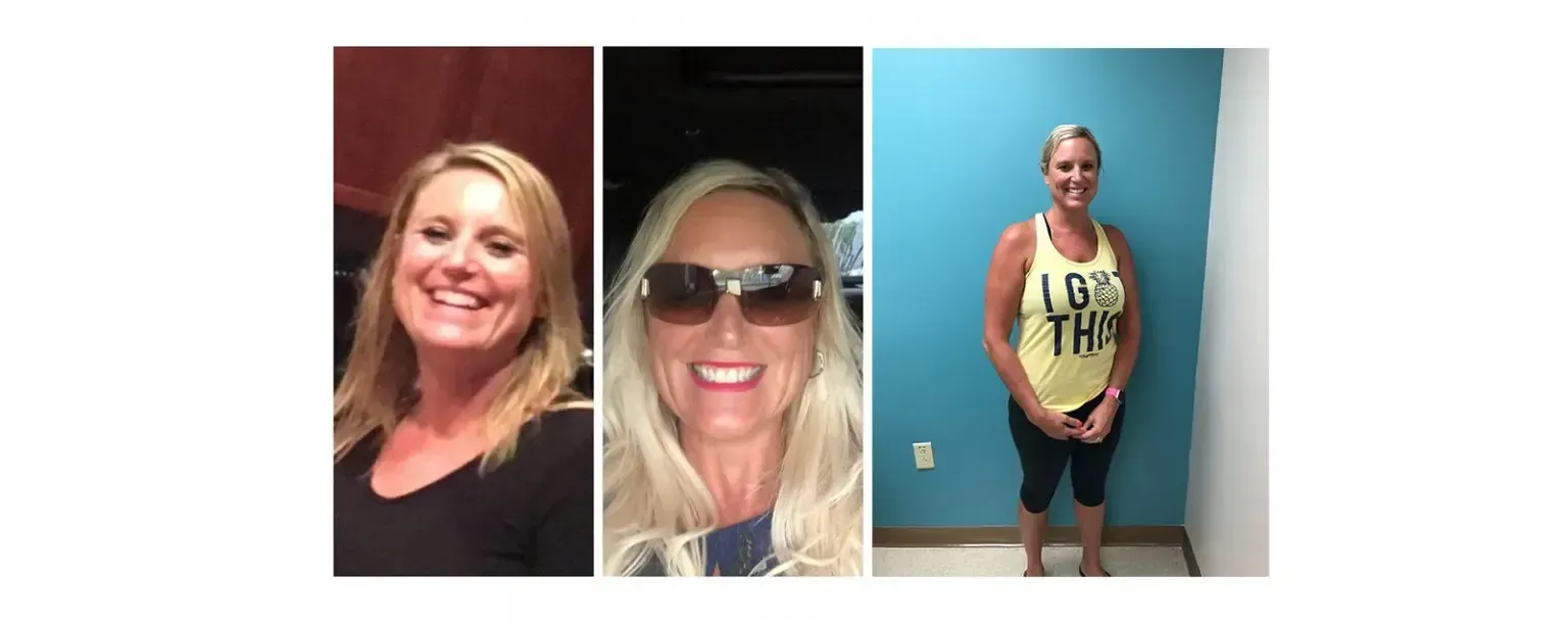 C.P. before and after