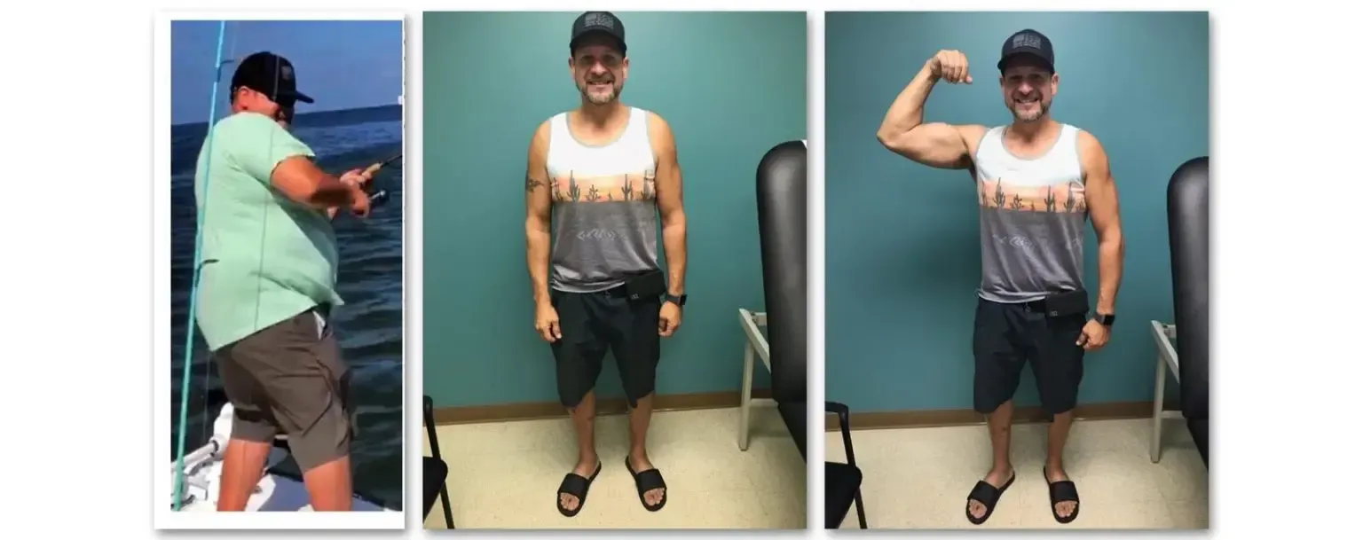 J.O. before and after