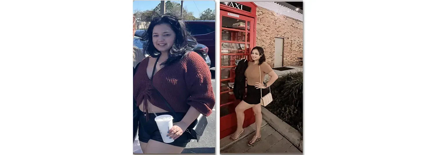 Layza before and after