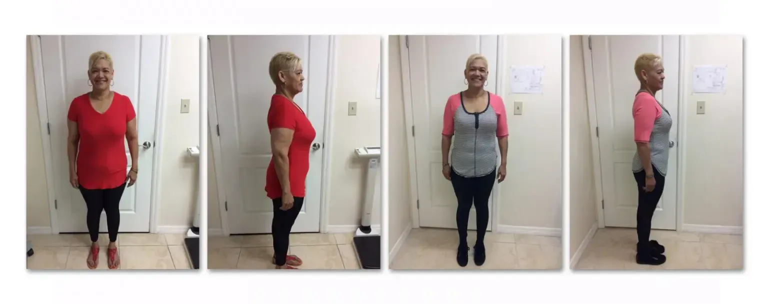 M.M. before and after